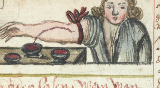 illustration of bloodletting